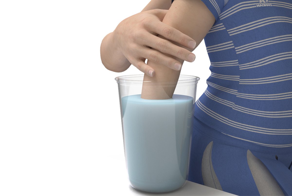 Abformset Alginat 3D Baby Hand Fuß Relief